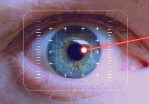 لیزر درمانی شناورهای چشم
