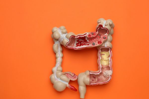  آندوسکوپی کامل معده 